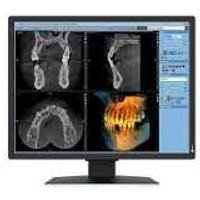 Eizo RadiForce MX217-SB Pantalla LCD 21" UXGA 1600x1200
